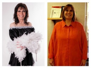 gastric bypass patient before after 