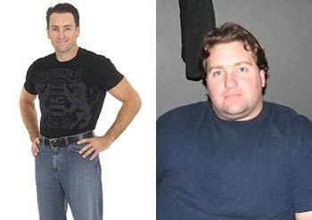 Dwight Before and After Gastric Bypass