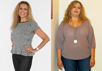 Yael Before and After Gastric Sleeve
